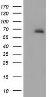 AFP Antibody in Western Blot (WB)