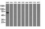 AFP Antibody in Western Blot (WB)