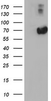 AFP Antibody in Western Blot (WB)