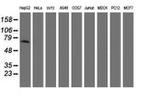 AFP Antibody in Western Blot (WB)