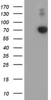 AFP Antibody in Western Blot (WB)