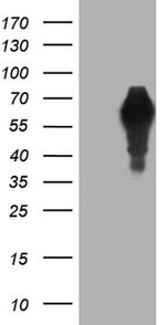 AFP Antibody in Western Blot (WB)