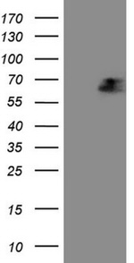 AFP Antibody in Western Blot (WB)