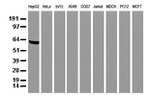 AFP Antibody in Western Blot (WB)
