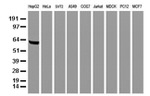 AFP Antibody in Western Blot (WB)