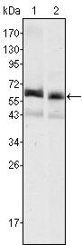 AFP Antibody in Western Blot (WB)