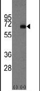 AFP Antibody in Western Blot (WB)