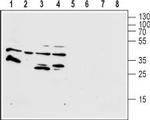 FPR1 (extracellular) Polyclonal Antibody