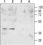 FPR2/ALX (extracellular) Polyclonal Antibody
