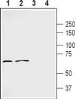 Frizzled-2 (FZD2) (extracellular) Polyclonal Antibody