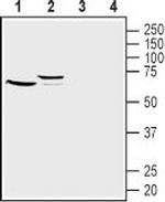 Frizzled-1 (FZD1) (extracellular) Polyclonal Antibody