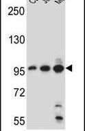 AFTPH Antibody in Western Blot (WB)
