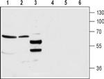 GABA(A) alpha 4 Receptor (extracellular) Antibody in Western Blot (WB)