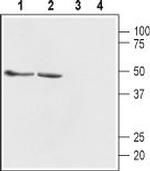 GABA(A) beta 1 Receptor Polyclonal Antibody