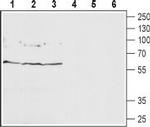 GABA(A) delta Receptor (extracellular) Antibody in Western Blot (WB)
