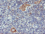 AGAP1 Antibody in Immunohistochemistry (Paraffin) (IHC (P))