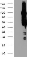 AGAP1 Antibody in Western Blot (WB)