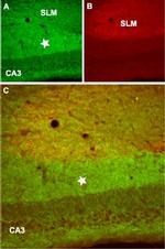 GABA(B) R2 Polyclonal Antibody