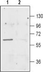 EAAT3 (EAAC1) Antibody in Western Blot (WB)