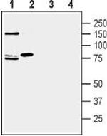 SLC1A7 (extracellular) Polyclonal Antibody