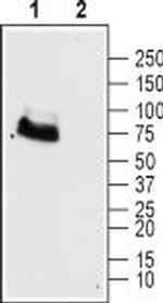 mGluR6 (extracellular) Polyclonal Antibody
