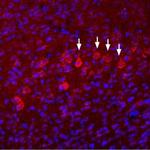 NMDAR3B (GRIN3B) (extracellular) Polyclonal Antibody