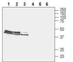 VGLUT2 Antibody in Western Blot (WB)