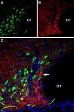 VGLUT2 Antibody in Multiplex Immunohistochemistry (mIHC)