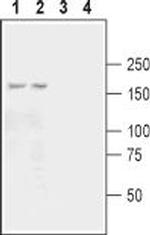 GRIK3 (GluK3) (extracellular) Antibody in Western Blot (WB)