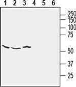 NETO2 (extracellular) Antibody in Western Blot (WB)