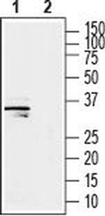 GSG1L Antibody in Western Blot (WB)