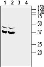 SynDIG1 Polyclonal Antibody