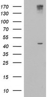 AGPAT5 Antibody in Western Blot (WB)