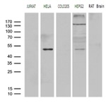 AGPAT9 Antibody in Western Blot (WB)