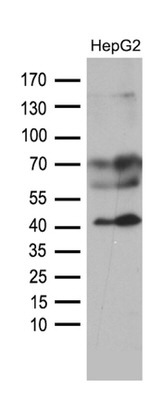 AGPAT9 Antibody in Western Blot (WB)