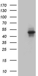 AGPAT9 Antibody in Western Blot (WB)