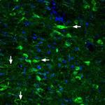 GLP2R (extracellular) Polyclonal Antibody