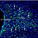 Glucagon Receptor (extracellular) Polyclonal Antibody