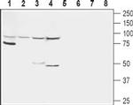 Glucagon Receptor (extracellular) Antibody in Western Blot (WB)