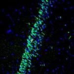 GIPR (extracellular) Polyclonal Antibody