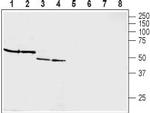 GIPR (extracellular) Antibody in Western Blot (WB)