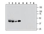 Secretin Receptor (extracellular) Antibody in Western Blot (WB)