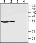 GnRH Receptor (extracellular) Antibody in Western Blot (WB)