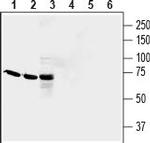 QRFPR/GPR103 (extracellular) Polyclonal Antibody