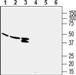 GPR132/G2A (extracellular) Polyclonal Antibody