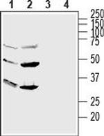 GPR56 (extracellular) Polyclonal Antibody