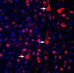 GPR17 Polyclonal Antibody