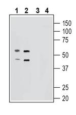 GPR139 Antibody in Western Blot (WB)