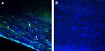 GPR143 Antibody in Immunohistochemistry (Frozen) (IHC (F))