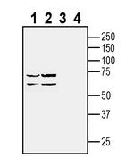 GPR143 Antibody in Western Blot (WB)